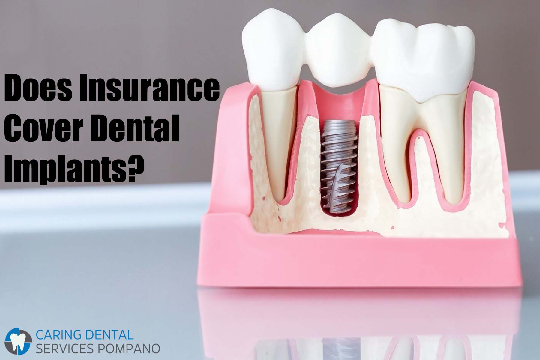 Does Insurance Cover Dental Implants?