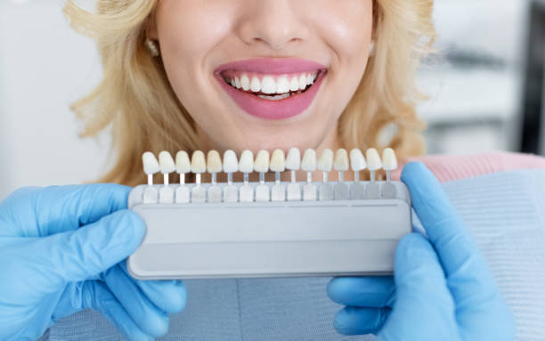Cosmetic Teeth Whitening: Fast, Safe, and Effective Results